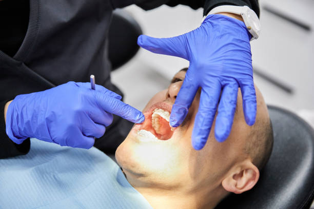 Best Emergency Tooth Extraction in Lincoln City, OR